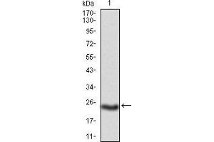 Western Blotting (WB) image for anti-Polycystic Kidney and Hepatic Disease 1 Protein (PKHD1) (AA 3878-4060) antibody (ABIN5874230) (PKHD1 Antikörper  (AA 3878-4060))