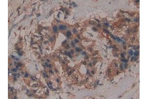 Immunohistochemistry (IHC) image for anti-Glutathione Peroxidase 4 (GPX4) (AA 74-197) antibody (ABIN7438652)
