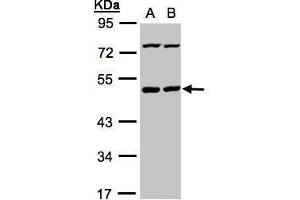 WB Image Sample(30 ug whole cell lysate) A:HeLa S3, B:Hep G2 , 10% SDS PAGE antibody diluted at 1:1000 (PSKH1 Antikörper)