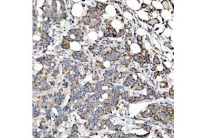 IHC analysis of MRPS25 using anti-MRPS25 antibody (ABIN7599032).