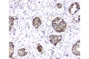 IHC analysis of TIMM17A using anti-TIMM17A antibody (ABIN6719637). (TIMM17A Antikörper)