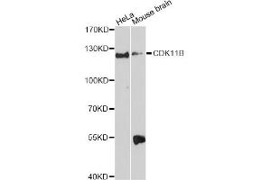 Western blot analysis of extracts of various cell lines, using CDK11B Antibody. (CDK11 Antikörper)