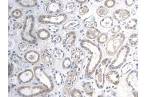 DAB staining on IHC-P; Samples: Human Esophagus (Galectin 2 Antikörper  (AA 1-132))