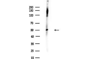 anti-Enolase Superfamily Member 1 (ENOSF1) (C-Term) antibody
