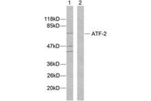 Western blot analysis of extracts from MDA-MB-435 cells, using ATF2 (Ab-112 or 94) Antibody. (ATF2 Antikörper  (AA 79-128))