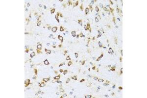 Immunohistochemistry of paraffin-embedded mouse brain using NRG4 antibody at dilution of 1:100 (40x lens). (Neuregulin 4 Antikörper)