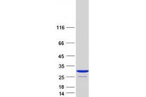 Western Blotting (WB) image for V-Crk Sarcoma Virus CT10 Oncogene Homolog (Avian) (CRK) (Transcript Variant 1) protein (Myc-DYKDDDDK Tag) (ABIN2712561)