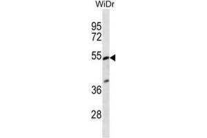 Western Blotting (WB) image for anti-Phosphatidylinositol Glycan Anchor Biosynthesis, Class V (PIGV) antibody (ABIN2997074) (PIGV Antikörper)