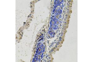 Immunohistochemistry of paraffin-embedded mouse lung using INHBB antibody at dilution of 1:100 (x40 lens). (INHBB Antikörper)