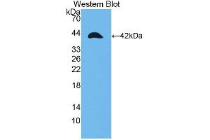 Western blot analysis of the recombinant protein. (TPM2 Antikörper  (AA 1-284))