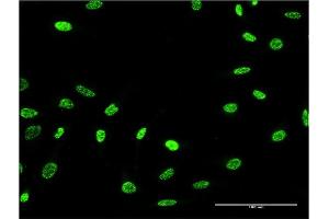 Immunofluorescence of monoclonal antibody to PTPN22 on HeLa cell. (PTPN22 Antikörper  (AA 10-113))