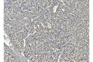 IHC analysis of ARG1 using anti-ARG1 antibody (ABIN6719532).