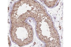 ABIN6266521 at 1/200 staining human testis tissue sections by IHC-P. (Cullin 2 Antikörper  (C-Term))
