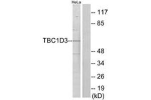 Western Blotting (WB) image for anti-TBC1 Domain Family, Member 3 (TBC1D3) (AA 481-530) antibody (ABIN2889670) (TBC1D3 Antikörper  (AA 481-530))