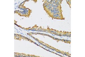 Immunohistochemistry of paraffin-embedded human prostate using CXCL11 antibody. (CXCL11 Antikörper)