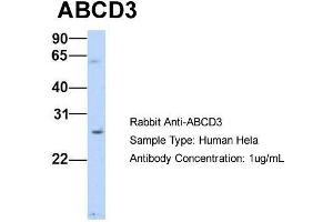 Host: Rabbit Target Name: ABCD3 Sample Type: Human Hela Antibody Dilution: 1.