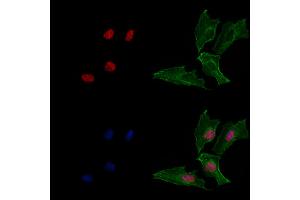 ABIN6265200 and ABIN6269069 staining  cells by IF/ICC. (SNAIL Antikörper  (C-Term))