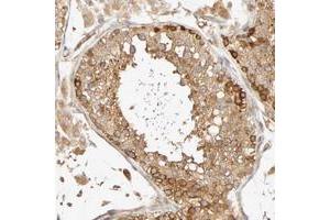 Immunohistochemical staining of human testis with SGSM1 polyclonal antibody  shows strong cytoplasmic positivity in cells in seminiferus ducts and moderate in Leydig cells at 1:10-1:20 dilution. (SGSM1 Antikörper)