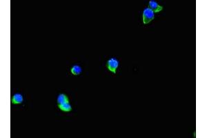Immunofluorescent analysis of Hela cells using ABIN7171701 at dilution of 1:100 and Alexa Fluor 488-congugated AffiniPure Goat Anti-Rabbit IgG(H+L) (TTI1 Antikörper  (AA 692-858))