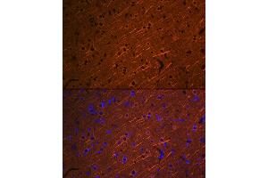 Immunofluorescence analysis of rat brain using βIII-Tubulin/β3-Tubulin Rabbit mAb (ABIN7271049) at dilution of 1:100 (40x lens). (TUBB3 Antikörper)