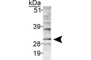 Western blot analysis of INSIG1 in HepG2 lyaste using INSIG1 polyclonal antibody . (INSIG1 Antikörper  (AA 1-100))