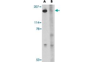 Western blot analysis of SLITRK5 in NIH/3T3 cell lysate with SLITRK5 polyclonal antibody  at 1 ug/mL in the (A) absence or (B) presence of blocking peptide. (SLITRK5 Antikörper  (Internal Region))