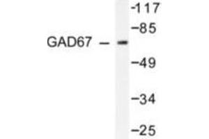 Image no. 2 for anti-Glutamate Decarboxylase 1 (Brain, 67kDa) (GAD1) antibody (ABIN265428) (GAD Antikörper)
