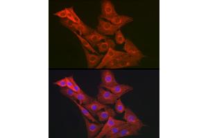 Immunofluorescence analysis of NIH-3T3 cells using GART Rabbit pAb (ABIN1679954, ABIN3018225, ABIN3018226 and ABIN6220407) at dilution of 1:200 (40x lens). (GART Antikörper  (AA 1-320))