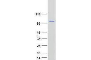 Radixin Protein (RDX) (Myc-DYKDDDDK Tag)