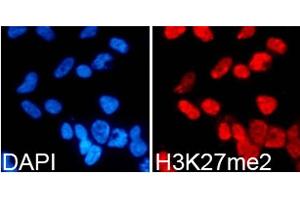 Immunofluorescence analysis of 293T cells using DiMethyl-Histone H3-K27 antibody. (Histone 3 Antikörper  (H3K27me))