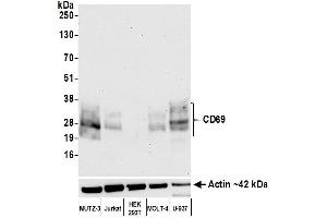 Western Blotting (WB) image for anti-CD69 (CD69) (AA 64-199) antibody (ABIN7449359)