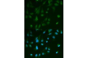 Immunofluorescence (IF) image for anti-Arrestin, beta 1 (ARRB1) (AA 169-418) antibody (ABIN3021265)