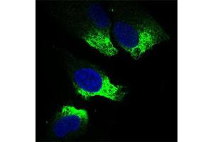 Immunofluorescence (IF) image for anti-Twist Homolog 1 (Drosophila) (TWIST1) (AA 9-74) antibody (ABIN1724845)