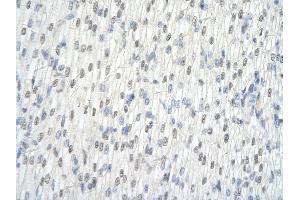 Immunohistochemistry (IHC) image for anti-Heterogeneous Nuclear Ribonucleoprotein L (HNRNPL) (N-Term) antibody (ABIN2778777)