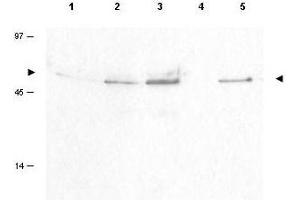 Image no. 1 for anti-Cyclin B1 (CCNB1) (pSer126) antibody (ABIN199908) (Cyclin B1 Antikörper  (pSer126))