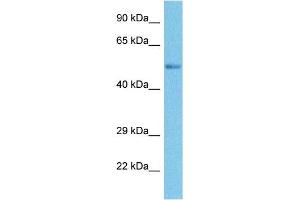 Host:  Rabbit  Target Name:  SMYD3  Sample Tissue:  Human Ovary Tumor  Antibody Dilution:  1ug/ml (SMYD3 Antikörper  (N-Term))