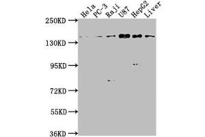 Western Blot Positive WB detected in: Hela whole cell lysate, PC-3 whole cell lysate, Raji whole cell lysate, U87 whole cell lysate, HepG2 whole cell lysate, Mouse liver tissue All lanes: MAP4K4 antibody at 1:1000 Secondary Goat polyclonal to rabbit IgG at 1/50000 dilution Predicted band size: 143, 139, 151, 134, 142, 146 kDa Observed band size: 143 kDa (MAP4K4 Antikörper  (AA 866-1104))