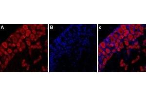 Expression of P2RX3 in rat DRG - Immunohistochemical staining of rat dorsal root ganglion (DRG) using Anti-P2X3 Receptor-ATTO Fluor-594 Antibody (ABIN7043421). (P2X3 Receptor (AA 383-397), (C-Term), (Intracellular) Antikörper (Atto 594))