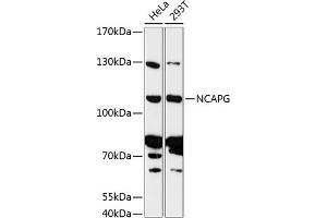 Western blot analysis of extracts of various cell lines, using NCAPG antibody (ABIN6130189, ABIN6144398, ABIN6144399 and ABIN6216998) at 1:3000 dilution. (NCAPG Antikörper  (AA 610-700))