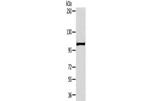 Gel: 6 % SDS-PAGE, Lysate: 40 μg, Lane: Mouse liver tissue, Primary antibody: ABIN7191695(NPR2 Antibody) at dilution 1/300, Secondary antibody: Goat anti rabbit IgG at 1/8000 dilution, Exposure time: 30 seconds (NPR2 Antikörper)