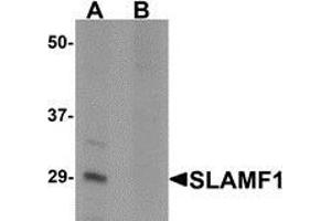 Western blot analysis of SLAMF1 in rat colon tissue lysate with SLAMF1 antibody at 1 μg/ml in (A) the absence and (B) the presence of blocking peptide (SLAMF1 Antikörper  (N-Term))