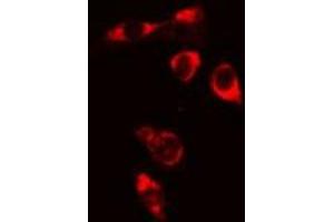 ABIN6276735 staining Hela cells by IF/ICC. (BTK Antikörper  (Internal Region))