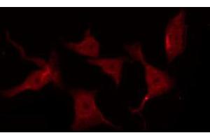 ABIN6267258 staining SK-OV3 by IF/ICC.