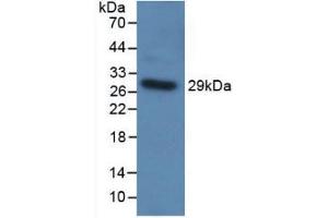 Western blot analysis of recombinant Human TLR5. (TLR5 Antikörper  (AA 303-514))