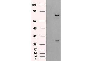 HEK293T cells were transfected with the pCMV6-ENTRY control (Left lane) or pCMV6-ENTRY DPP4 (Right lane) cDNA for 48 hrs and lysed. (DPP4 Antikörper)