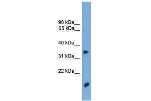 WB Suggested Anti-TMPRSS3 Antibody Titration: 0.