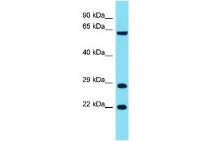 Host: Rabbit Target Name: FAM220A Sample Type: COLO205 Whole Cell lysates Antibody Dilution: 1. (Family with Sequence Similarity 220, Member A (FAM220A) (Middle Region) Antikörper)
