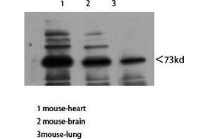 Western Blot (WB) analysis of Mouse Heart Mouse Brain Mouse Lung using Neuregulin-3 Polyclonal Antibody diluted at 1:800. (Neuregulin 3 Antikörper  (Internal Region))