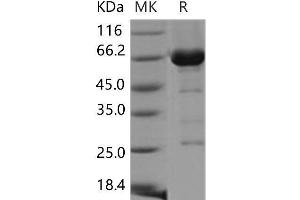 Western Blotting (WB) image for Cell Division Cycle 37 Homolog (S. Cerevisiae) (CDC37) protein (GST tag,His tag) (ABIN7320133)