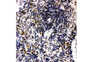 Anti-Nucleophosmin antibody, IHC(P) IHC(P): Rat Spleen Tissue
